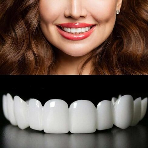 Veneers Teeth for Women and Men, Nature and Comfortable, Tooth Replacement Kit in Kuwait