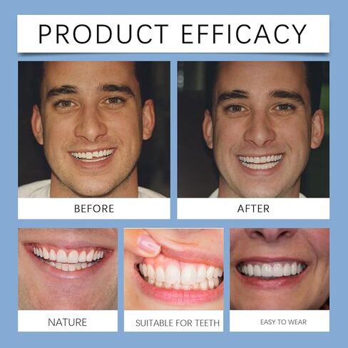 Veneers Teeth for Women and Men, Nature and Comfortable, Tooth Replacement Kit in Kuwait