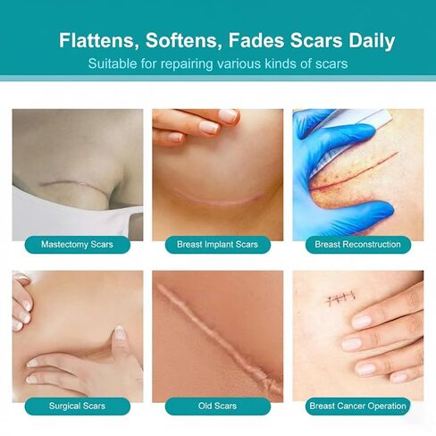 Silicone Scar Sheets - 8-Pack Medical Grade & Reusable Breast Scar Tape for Surgery Recovery, Waterproof & Breathable Professional Scar Treatment in Kuwait