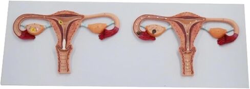 Anatomical Fertilization Process Model, Cross-Section of Female Reproductive Organs in Kuwait