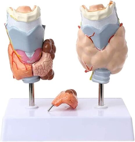 Anatomy Models, Thyroid Pathology, Medical Education Teaching Aids in Kuwait