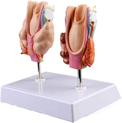 Anatomy Models, Thyroid Pathology, Medical Education Teaching Aids in Kuwait