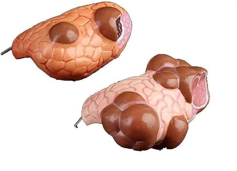 Anatomy Models, Thyroid Pathology, Medical Education Teaching Aids in Kuwait