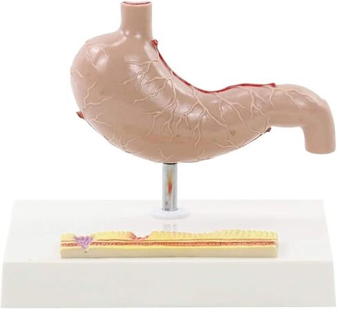 Stomach Anatomical Model Human Organ Pathology Teaching Aids in Kuwait