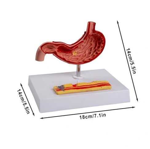 Stomach Anatomical Model Human Organ Pathology Teaching Aids in Kuwait