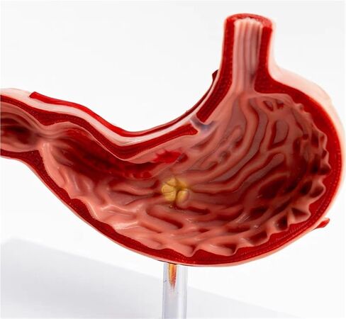 Stomach Anatomical Model Human Organ Pathology Teaching Aids in Kuwait