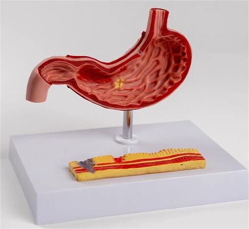 Stomach Anatomical Model Human Organ Pathology Teaching Aids in Kuwait
