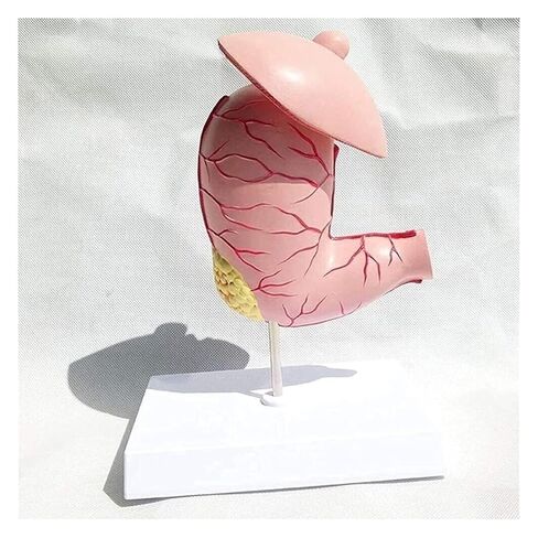 Stomach Disease Anatomical Model, Human, Digestive System Medical in Kuwait