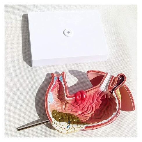 Stomach Disease Anatomical Model, Human, Digestive System Medical in Kuwait