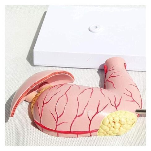 Stomach Disease Anatomical Model, Human, Digestive System Medical in Kuwait