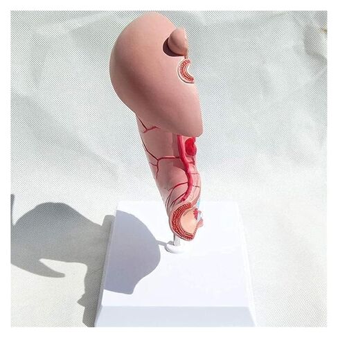 Stomach Disease Anatomical Model, Human, Digestive System Medical in Kuwait