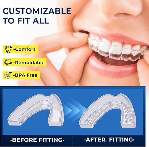 Mouth Guard for Grinding Teeth at Night: Mouth Guard for Sleeping - Night Guard for Teeth Grinding Home & Travel Use in Kuwait