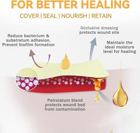 Jointown Xeroform Petrolatum Dressing Bandages, Soft Mesh Gauze Patch for Wound Care, Burns, Lacerations, Skin Grafts & Surgical Incisions, 4"x4", 25 Individual Pack in Kuwait