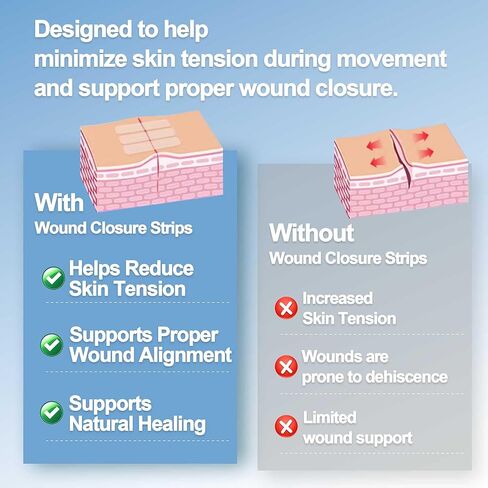 شرائط إغلاق الجروح المعقمة، 12 مم × 100 مم، 20 عبوة (ورقتان في كل عبوة، 3 شرائط في كل ورقة)، قابلة للتنفس ولا تسبب الحساسية، للجروح الصغيرة، والعناية بعد الخياطة والإسعافات الأولية، إجمالي 120 شريطًا in Kuwait