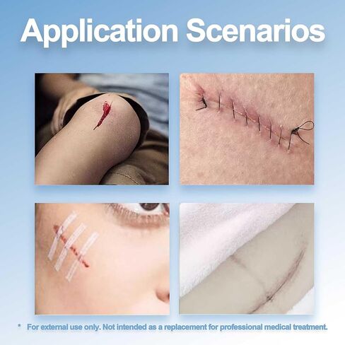 شرائط إغلاق الجروح المعقمة، 12 مم × 100 مم، 20 عبوة (ورقتان في كل عبوة، 3 شرائط في كل ورقة)، قابلة للتنفس ولا تسبب الحساسية، للجروح الصغيرة، والعناية بعد الخياطة والإسعافات الأولية، إجمالي 120 شريطًا in Kuwait