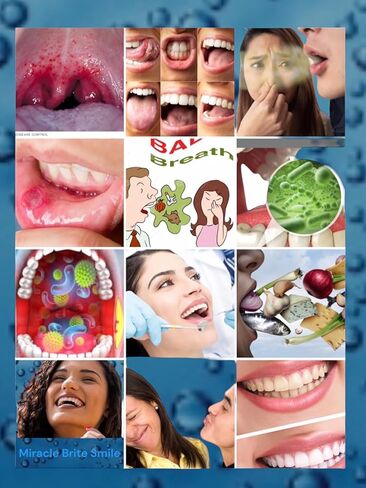 Miracle Brite Smile - 3% Hydrogen Peroxide Medical Food Grade, Peppermint, Lemon, Clove Leaf, Cinnamon and Rosemary in Kuwait