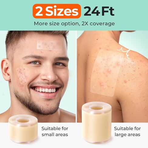 لفة غرواني مائي بحجمين من TKTK، (2 بوصة * 12 قدم + 1 بوصة * 12 قدم) ضمادات غرواني مائي، رقعة غرواني مائي لحب الشباب والجروح والحروق والعناية بالبثور، ورقع البثور مع دعامة سهلة التقشير، مقاومة للماء وفائقة الامتصاص in Kuwait