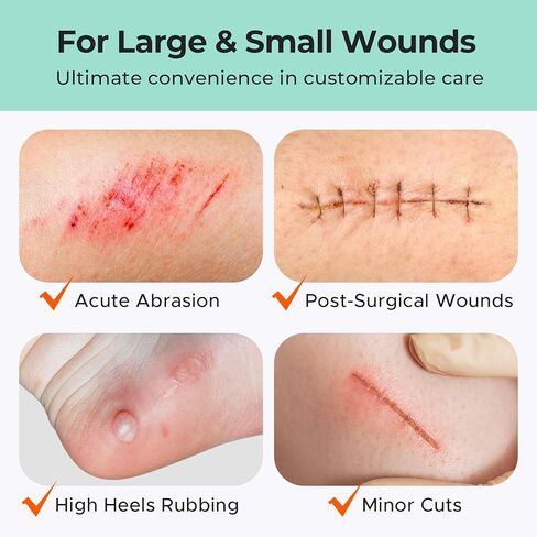 لفة غرواني مائي بحجمين من TKTK، (2 بوصة * 12 قدم + 1 بوصة * 12 قدم) ضمادات غرواني مائي، رقعة غرواني مائي لحب الشباب والجروح والحروق والعناية بالبثور، ورقع البثور مع دعامة سهلة التقشير، مقاومة للماء وفائقة الامتصاص in Kuwait