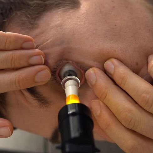 S5 Mini™: for Easy and Accurate Scleral & Hybrid Lens Insertion - Perfectly Align Your Eye with The Center of The Lens and Use 2 Hands to Hold Your Eyelids Open in Saudi Arabia