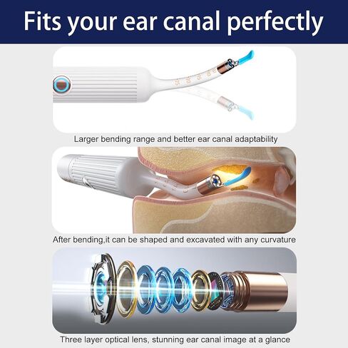 كاميرا أداة إزالة شمع الأذن، منظف الأذن الذكي واي فاي مع الكاميرا، منظار الأذن البصري عالي الدقة، مجموعة ملاقط ومجارف مرنة من السيليكون الآمن للبالغين والأطفال in Kuwait