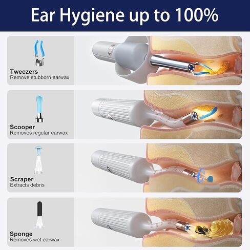 كاميرا أداة إزالة شمع الأذن، منظف الأذن الذكي واي فاي مع الكاميرا، منظار الأذن البصري عالي الدقة، مجموعة ملاقط ومجارف مرنة من السيليكون الآمن للبالغين والأطفال in Kuwait