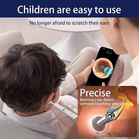 كاميرا أداة إزالة شمع الأذن، منظف الأذن الذكي واي فاي مع الكاميرا، منظار الأذن البصري عالي الدقة، مجموعة ملاقط ومجارف مرنة من السيليكون الآمن للبالغين والأطفال in Kuwait
