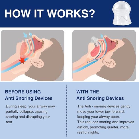 جهاز مضاد للشخير، حل للشخير أثناء النوم للرجال والنساء، سدادة حل الشخير قابلة لإعادة الاستخدام -F03 in Kuwait