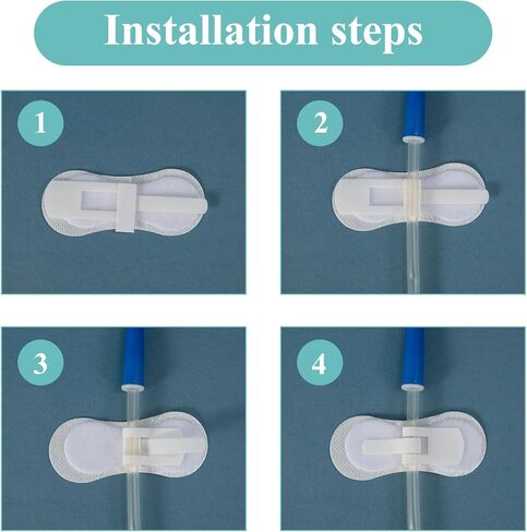 10 عبوات من وسادات أنبوب تغذية القسطرة PD + 10 عبوات من حامل أنبوب التغذية، ضمادات لاصقة مقسمة، أغطية أنبوب G، جهاز تثبيت القسطرة، ضمادة لاصقة ذاتية اللصق، مستلزمات أنبوب التغذية in Kuwait