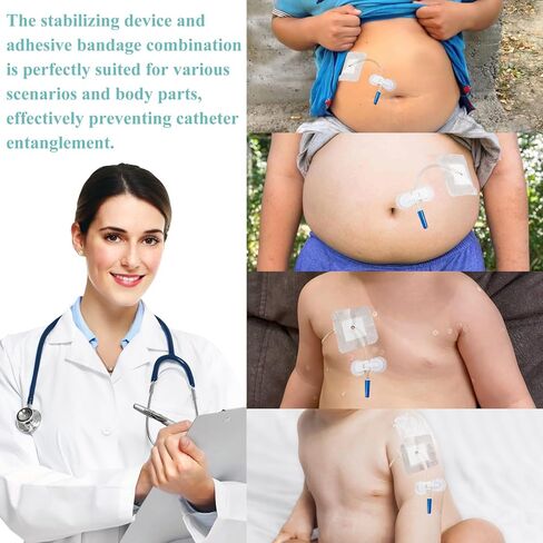 10 عبوات من وسادات أنبوب تغذية القسطرة PD + 10 عبوات من حامل أنبوب التغذية، ضمادات لاصقة مقسمة، أغطية أنبوب G، جهاز تثبيت القسطرة، ضمادة لاصقة ذاتية اللصق، مستلزمات أنبوب التغذية in Kuwait
