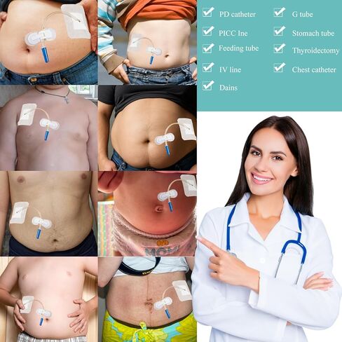 10 عبوات من وسادات أنبوب تغذية القسطرة PD + 10 عبوات من حامل أنبوب التغذية، ضمادات لاصقة مقسمة، أغطية أنبوب G، جهاز تثبيت القسطرة، ضمادة لاصقة ذاتية اللصق، مستلزمات أنبوب التغذية in Kuwait