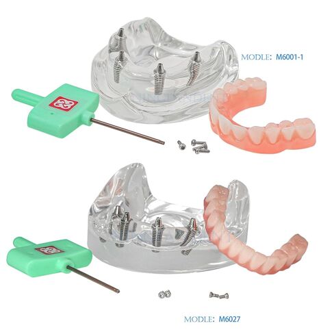 Dental Typodont Implant Transparent Model, Upper Lower Jaw Type, Malong Bridge,Removable All-on-4 Restoration Overdenture, with 4 Implants (Typodont Implant Upper+Lower Jaw Kit M6001+6027) in Saudi Arabia