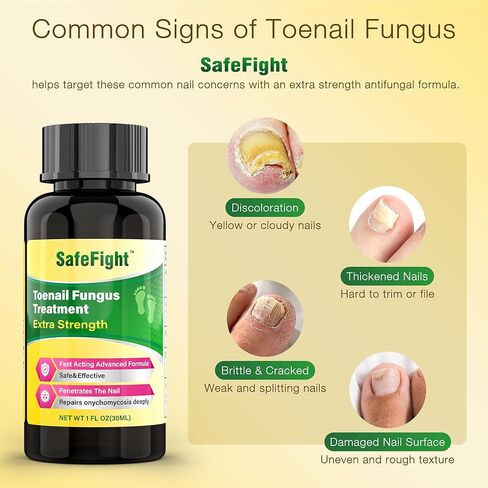 Toenail Fungus Treatment with 25% Undecylenic Acid & Tolnaftate - SafeFight Nail Repair Solution for Fungi Nail, Toenail Fungus Treatment Extra Strength Nail Repair for Fungi Nail 30ml in Kuwait