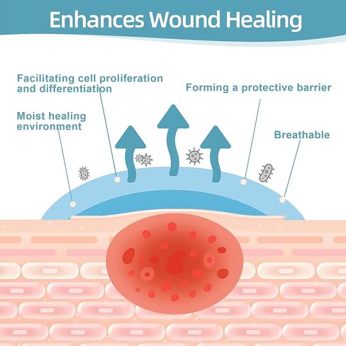 Hydrocolloid Bandages for Wound Care Dressing, 6.6ft Hydrocolloid Roll DIY Size & Shape Hydrocolloid Patch Tape with Self-Adhesive for Burn, Blister, Acne Care (2in x 6.6ft) in Kuwait