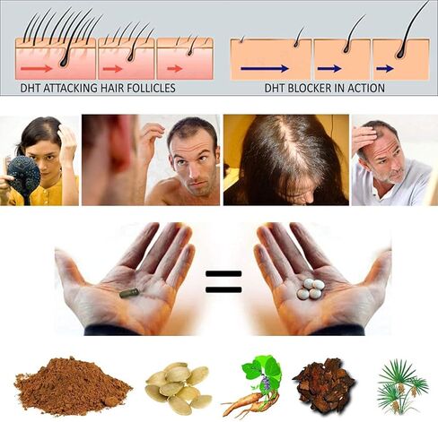 الأصلي النقي الطبيعي X2 العمل البيوتين DHT مانع بيتا سيتوستيرول FL المصدر الطبيعي زيت البلميط البري يمنع ويوقف تساقط الشعر، تقوية الجذور، يعزز تدفق البول، دعم البروستاتا in Kuwait
