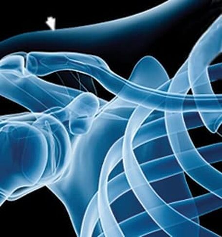 علامات الجلد Suremark Arrow - سهم الرصاص 1 مم × 8 مم، 100 لكل صندوق in Kuwait