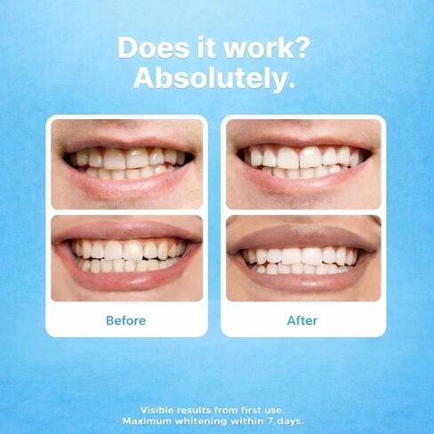 JUMU'AH Teeth Whitening Pen, Certified Non-Toxic Whitening Pen, Enamel-Safe, Whitening Without the Sensitivity, A Healthy Way to Whitening (Pack of 1-2ML) in Saudi Arabia