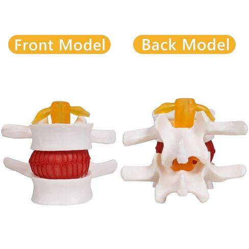 نموذج فتق القرص القطني التشريحي البشري من بريسكي: 1.5 مرة بالحجم الطبيعي للقرص القطني أداة نموذج للتدريس - للعروض الطبية والتعلم والتعليم والعروض العلمية in Kuwait