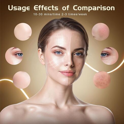 العلاج بالضوء الأحمر اللاسلكي للوجه من BNU، قناع العلاج بالضوء LED بـ 4 أوضاع مع 400 خرزة LED، جهاز تحكم عن بعد مزدوج 1000 مللي أمبير في الساعة، علاج بالضوء الأحمر بالأشعة تحت الحمراء 850 نانومتر لمكافحة الشيخوخة في المنزل والسفر in Kuwait