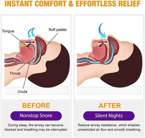 بخاخ مضاد للشخير، محلول للشخير للمساعدة في فتح الحلق وممر الهواء، حل فعال لوقف الشخير in Kuwait