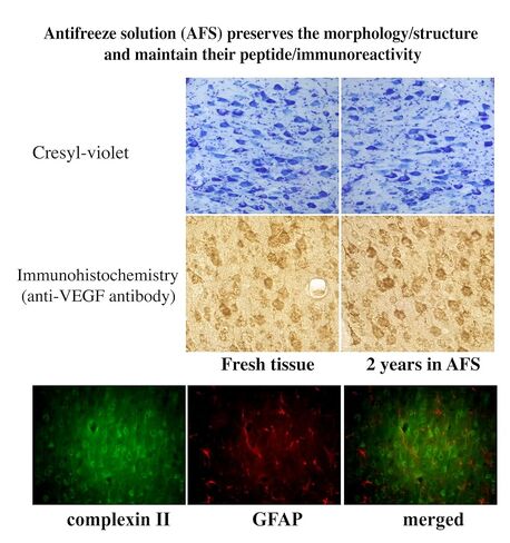 Tissue Cryoprotectant, Anti Freeze Solution 500mL in Kuwait