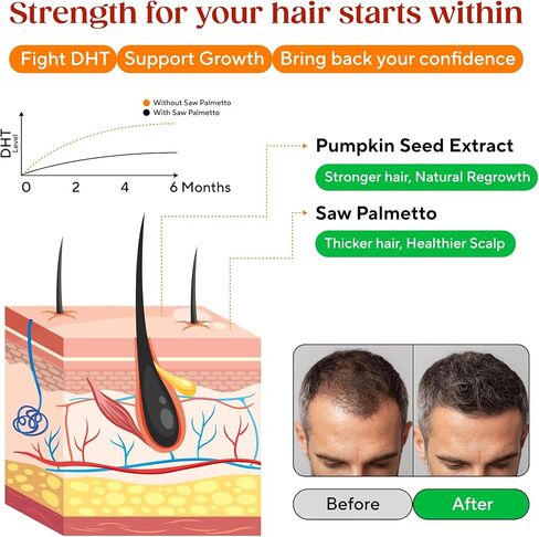 Saw Palmetto Gummies for Hair Growth & Hormone Balance – Vegan DHT Blocker for Women & Men, Supports Prostate Health, PCOS & Testosterone Wellness – Gluten-Free Herbal Supplement – 300mg Extract in Saudi Arabia