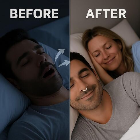 Nasal Dilators for Sleeping – 8 Pack Anti Snoring Nose Vents + Travel Case – Comfortable & Reusable Silicone Snore Stopper Nose Clips for Snore Relief in Saudi Arabia