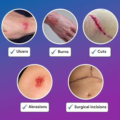 ضمادة هيدروجيل بالعسل مقاس 17.78 سم × 12.7 سم - 10 ورقات هيدروجيل مع عسل طبي بنسبة 30% للجروح - جيد للقروح والجروح الجراحية ومواقع المتبرعين والجروح والسحجات والمزيد in Kuwait