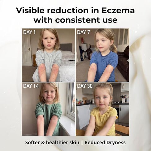 كريم سفين آيلاند ميراكل مانوكا (8.8 أونصة) | كريم الأكزيما الطبيعي الخالي من الستيرويد ومرطب الوجه | معتمد من الجلد | بزيت أوراق المانوكا | للبشرة الجافة والرضع والكبار | صنع في نيوزيلندا in Kuwait