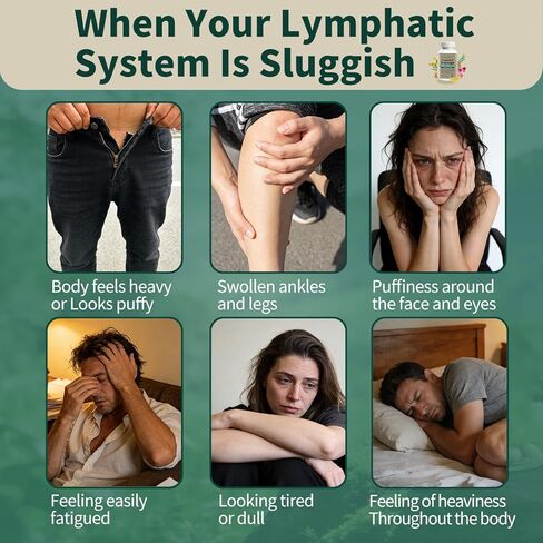 Lymphatic Drainage Supplement – Natural Herbal Formula with Dandelion, Burdock & Echinacea, Supports Fluid Balance, Immune Health & Cellulite Reduction – 60 Capsules in Saudi Arabia