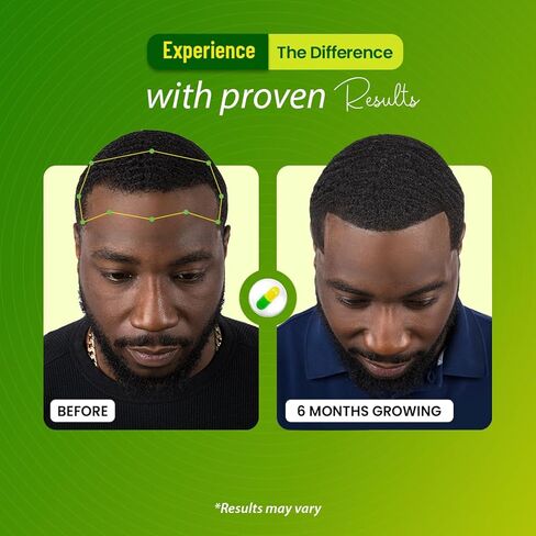 فيتامينات نمو الشعر ذات القوة الجذرية - فيتامينات الشعر للنساء والرجال ذوي البشرة السمراء مع مانع DHT والكولاجين، البيوتين المتقدم لنمو الشعر للنساء، 60 كبسولة، كمية تكفي لمدة شهر واحد، لشعر أكثر سمكًا وأقوى in Kuwait