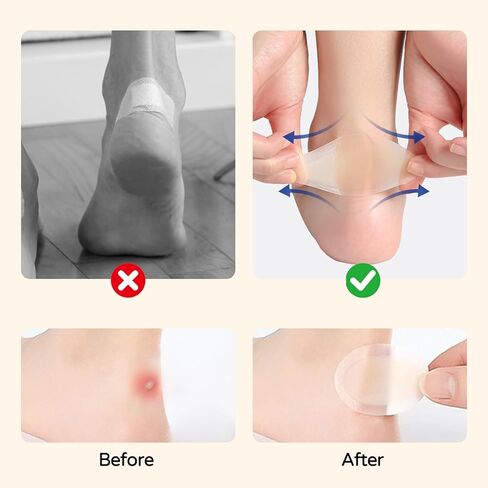 36PCS Hydrocolloid Blister Bandages – Waterproof Gel Cushions Pads for Blister Prevention & Relief, Feet & Toes Blister Prevention & Recovery (Variety Pack) in Kuwait