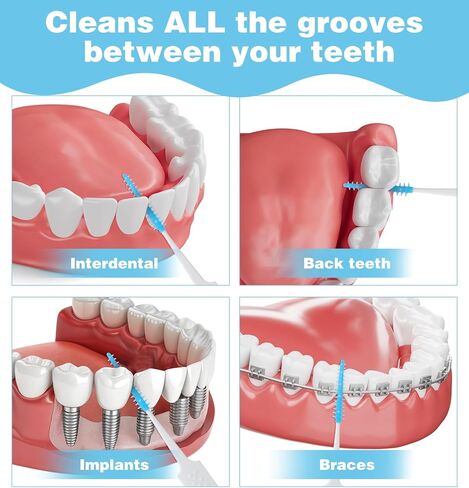 300 Pcs Tooth Picks, Soft Dental Floss Picks for Braces, Dental Tooth Cleaners for Tight Gaps, Flossing & Orthodontic Care in Saudi Arabia