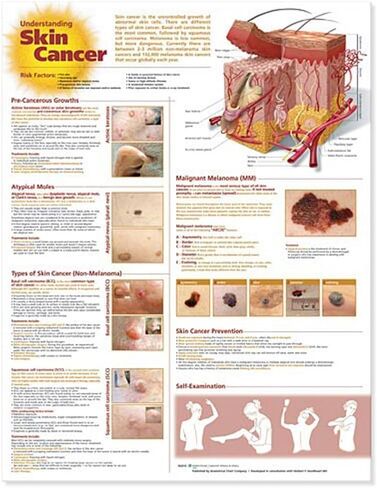 فهم الرسم البياني التشريحي لسرطان الجلد in Kuwait