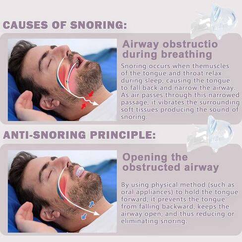 حل الشخير - أجهزة مكافحة الشخير، 2 عبوة جهاز سدادة الشخير للرجال والنساء - H89 in Kuwait